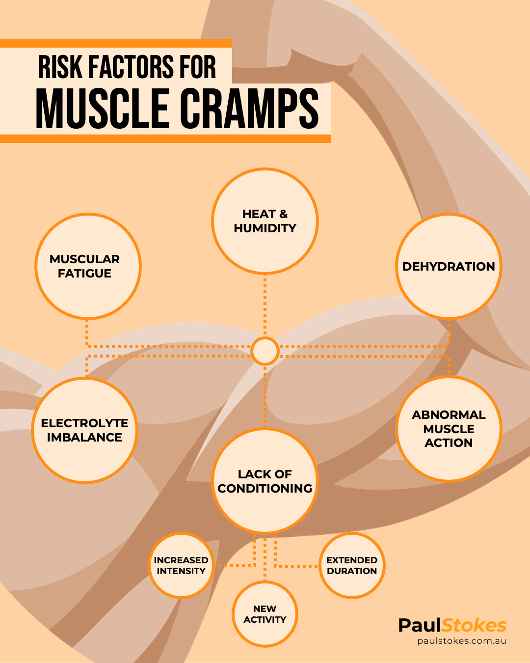 Infographic listing several risk factors for exercise-induced muscle cramps